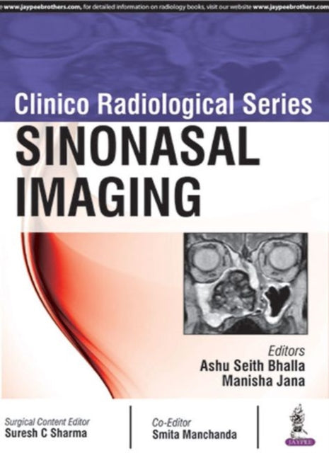 Book cover of: Clinico Radiological Series: Sinonasal Imaging. By: Ashu Seith Bhalla