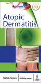 Book cover of: Atopic Dermatitis. By: Satish Udare