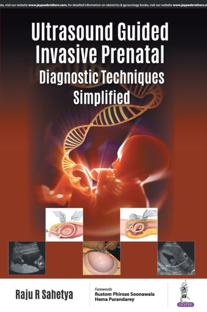 Book cover of: Ultrasound Guided Invasive Prenatal Diagnostic Techniques Simplified. By: Raju R. Sahetya