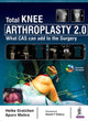 Book cover of: Total Knee Arthroplasty 2.0. By: Heiko Graichen