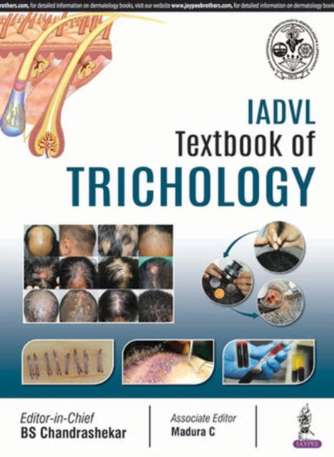 Book cover of: IADVL Textbook of Trichology. By: B. S. Chandrashekar