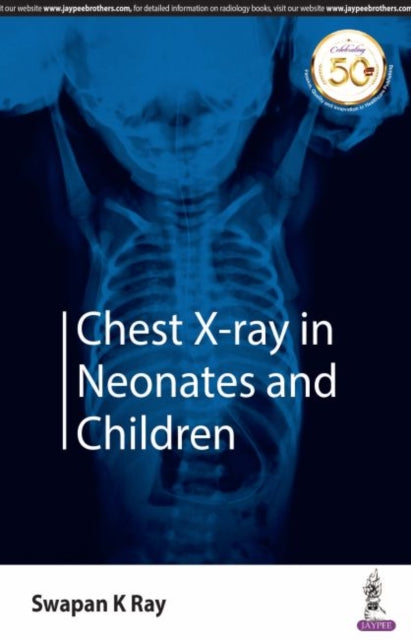 Book cover of: Chest X-ray in Neonates and Children. By: K. Swapan Ray