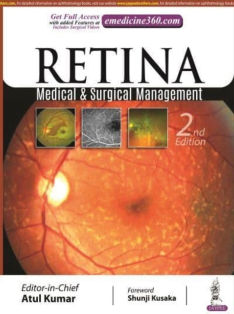 Book cover of: Retina. By: Atul Kumar