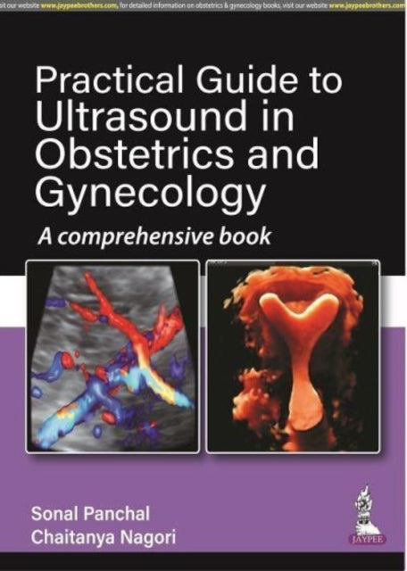 Book cover of: Practical Guide to Ultrasound in Obstetrics and Gynecology. By: Sonal Panchal