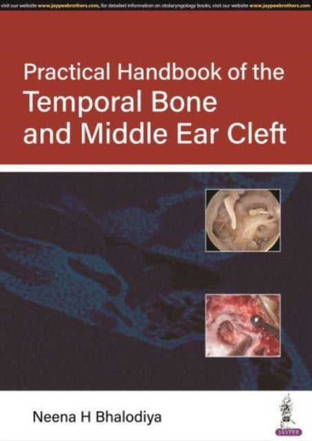 Book cover of: Practical Handbook of the Temporal Bone and Middle Ear Cleft. By: Neena H. Bhalodiya
