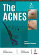 Book cover of: Acnes. By: Jayakar Thomas