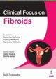 Book cover of: Clinical Focus on Fibroids