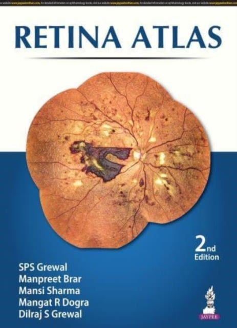 Book cover of: Retina Atlas. By: S. P. S. Grewal