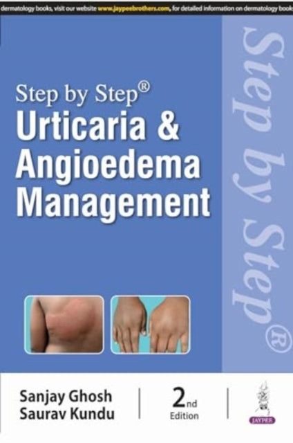 Book cover of: Step by Step: Urticaria & Angioedema Management. By: Kundu GHOSH