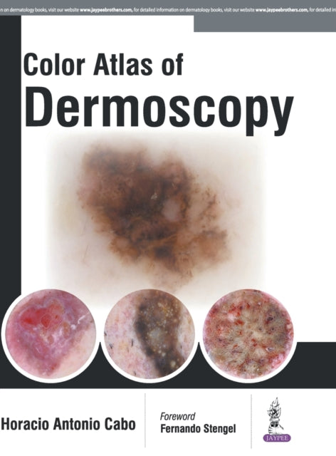 Book cover of: Color Atlas of Dermoscopy. By: Horacio Cabo