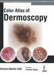 Book cover of: Color Atlas of Dermoscopy. By: Horacio Cabo