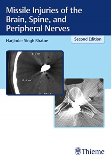 Book cover of: Missile Injuries of the Brain, Spine, and Peripheral Nerves. By: Harjinder S. Bhatoe