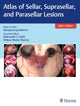 Book cover of: Atlas of Sellar, Suprasellar, and Parasellar Lesions. By: Narayanan Janakiram