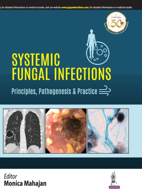 Book cover of: Systemic Fungal Infections: Principles, Pathogenesis & Practice. By: Monica Mahajan