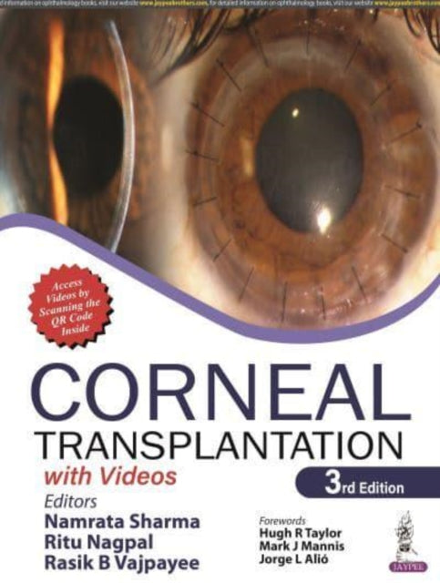 Book cover of: Corneal Transplantation. By: Namrata Sharma