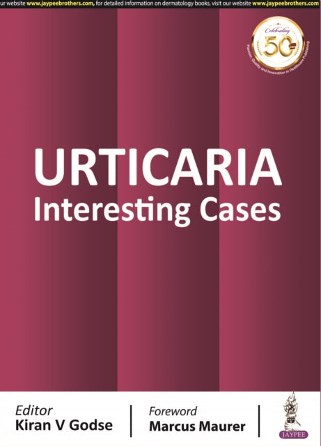 Book cover of: Urticaria. By: Kiran V. Godse