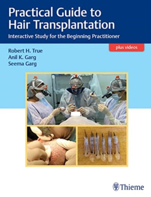 Book cover of: Practical Guide to Hair Transplantation. By: Robert True