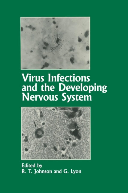 Book cover of: Virus Infections and the Developing Nervous System. By: R. T. Johnson