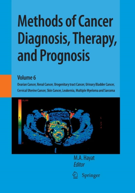 Book cover of: Methods of Cancer Diagnosis, Therapy, and Prognosis. By: M. A. Hayat