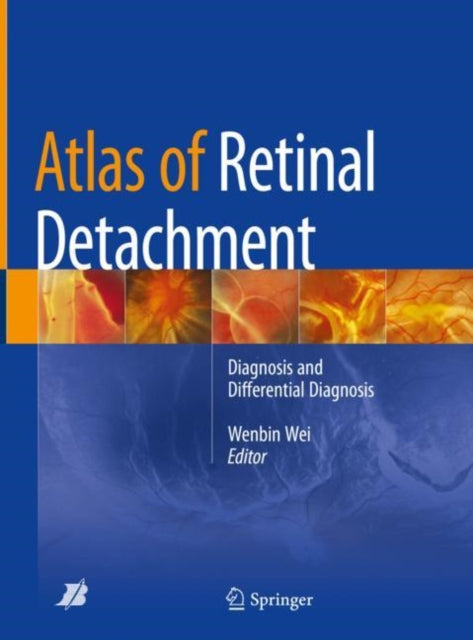 Book cover of: Atlas of Retinal Detachment. By: Wenbin Wei