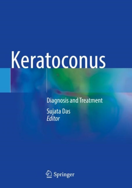 Book cover of: Keratoconus. By: Sujata Das