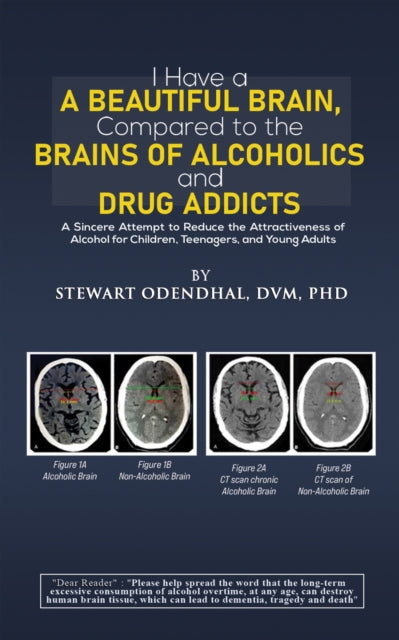 Book cover of: I Have a Beautiful Brain, Compared to the Brains of Alcoholics and Drug Addicts